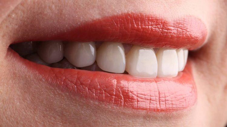 美白牙齒別亂貼！張箭球：「『陶瓷貼片』是牙齒美學最後一哩路」