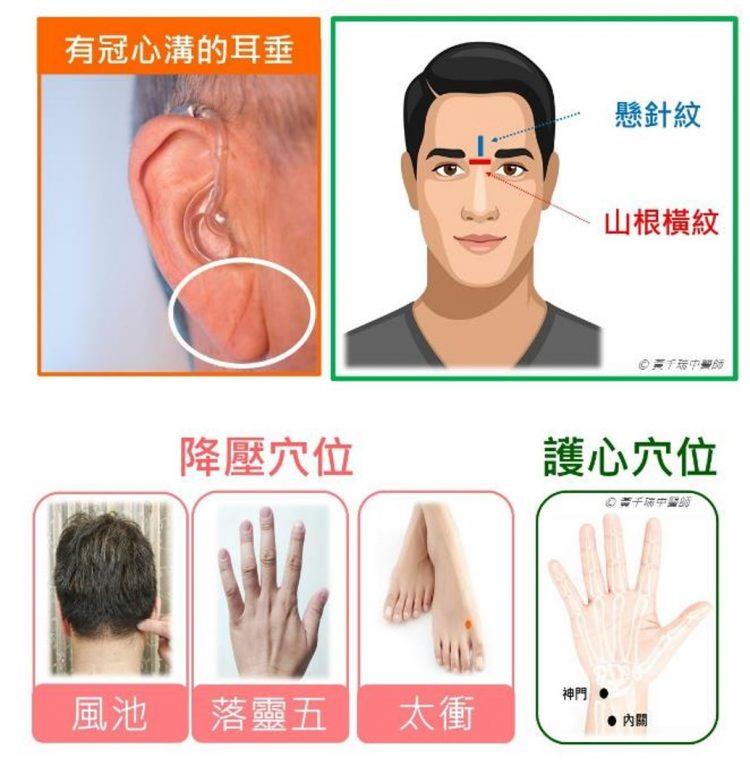 200927_馬光中醫_穴道照片