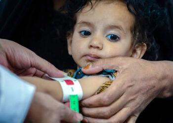 當娜迪亞來到展望會設立的行動診所，護理師很快檢查出她患有急性營養不良，需要緊急治療