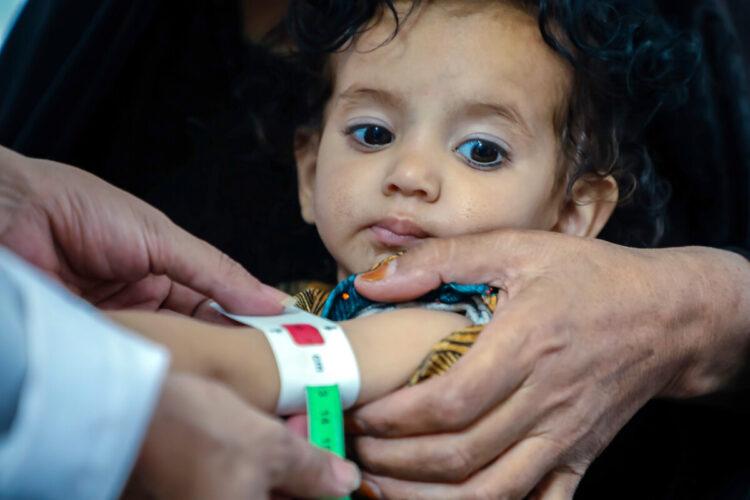 當娜迪亞來到展望會設立的行動診所，護理師很快檢查出她患有急性營養不良，需要緊急治療